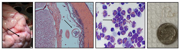 P. tenuis worm on the surface of the brain